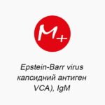 Epstein-Barr virus (капсидный антиген, VCA), IgM