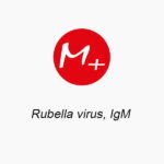 Rubella virus, IgМ