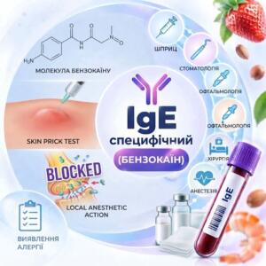 Allergy panel: Determination of specific IgE to benzocaine