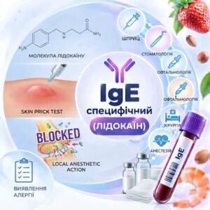 Кругла медична інфографіка для алергологічної діагностики на лідокаїн (IgE), що містить структурну формулу молекули лідокаїну, пробірку з біоматеріалом, імуноглобуліновий символ та піктограми медичних напрямків.