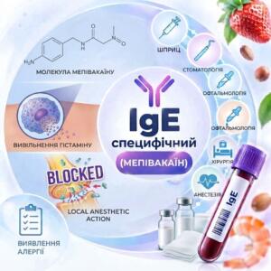 Кругла медична інфографіка для алергологічного тесту на мепівакаїн (IgE), що містить хімічну формулу мепівакаїну, схему вивільнення гістаміну з клітини, візуалізацію дії місцевого анестетика, піктограми медичних спеціальностей та пробірку з біоматеріалом у центрі.