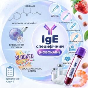Кругла медична інфографіка для алергологічного тесту на новокаїн (IgE), що містить хімічну формулу новокаїну, схему вивільнення гістаміну, візуалізацію дії місцевого анестетика, піктограми медичних спеціальностей та пробірку з біоматеріалом у центрі.