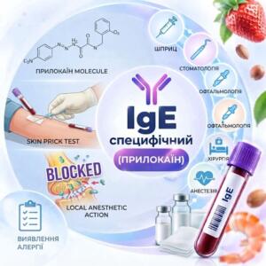 Round medical infographic for immunoallergy diagnostics for prilocaine (cytanest), containing a patient image, chemical formula of the drug, test tube with biomaterial and profile medical pictograms in a uniform series style.
