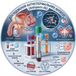 Medical infographic: Antisperm antibody (ASA) test - diagnosis of immunological infertility
