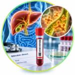 Blood test for direct bilirubin (Bilirubin direct) — Medi Lab Plus