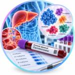 Analysis of protein fractions (proteinogram) — Medi Lab Plus