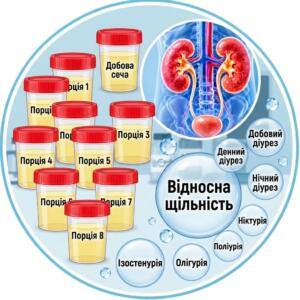 Контейнери для збору порцій сечі та схемне зображення нирок для аналізу сечі за Зимницьким.