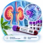 Cystatin C blood test to assess kidney function — Medi Lab Plus