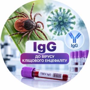 IgG до вірусу кліщового енцефаліту