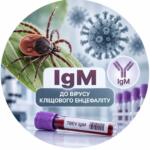 Выявление IgM антител к вирусу клещевого энцефалита