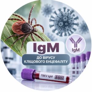 Виявлення IgM антитіл до вірусу кліщового енцефаліту