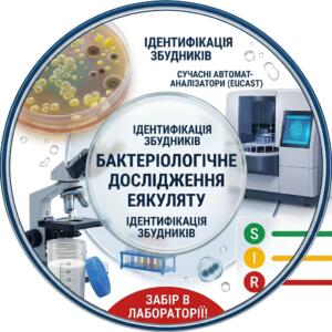Бактеріологічне дослідження еякуляту з ідентифікацією збудників та визначенням антибіотикограми за методологією EUCAST на автоматичних аналізаторах AF300 і Scan4000.
