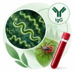 Borrelia burgdorferi s.l. (бореліоз), IgG — лабораторне дослідження