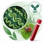 Borrelia burgdorferi sl (borreliosis), IgM — laboratory test