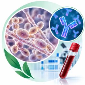 Candida albicans (кандидоз), IgG — лабораторне дослідження