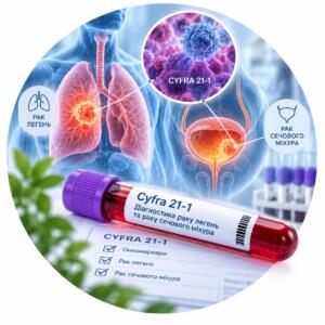 Аналіз CYFRA 21-1 для діагностики раку легень та сечового міхура — Меді Лаб Плюс