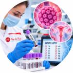Differential DNA detection of 12 types of human papillomavirus (HPV) by PCR — Medi Lab Plus