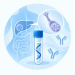 Echinococcus granulosus (echinococcosis), IgG — laboratory test