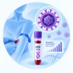 Epstein-Barr virus — Real-time PCR, кількісне визначення у крові
