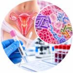 Femoflor-Screen — PCR study of the microflora of the urogenital tract to identify opportunistic microorganisms