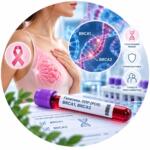 Analysis of BRCA1, BRCA2 genetic polymorphisms by PCR method — Medi Lab Plus