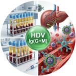 Медична інфографіка: Гепатит D (HDV) Ig (G+M) — серологічна діагностика антитіл до вірусу