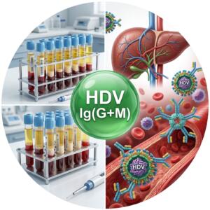 Medical infographic: Hepatitis D (HDV) Ig (G+M) — serological diagnosis of antibodies to the virus