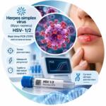 Herpes simplex virus HSV-1/2 — Real-time PCR, якісне визначення