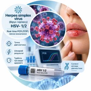 Herpes simplex virus HSV-1/2 — Real-time PCR, якісне визначення