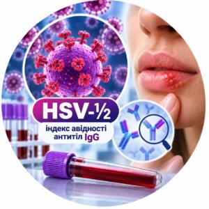 HSV-½ — індекс авідності антитіл IgG