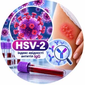 HSV-2 — індекс авідності антитіл IgG