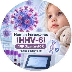 Human herpesvirus (HHV-6) — ПЛР (Real-time PCR), якісне визначення