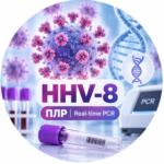 ПЛР-дослідження HHV-8 методом Real-time PCR
