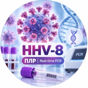 ПЛР-дослідження HHV-8 методом Real-time PCR