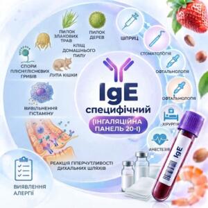 Професійна кругла медична інфографіка для діагностики інгаляційної алергії (панель 20-I), що містить зображення поширених алергенів, схему вивільнення гістаміну, реакцію дихальних шляхів та піктограми медичних процедур.