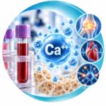 Анализ ионизированного кальция (Ca++, Calcium Ionized) - Меди Лаб Плюс