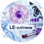 LE-клетки - исследование клеток крови