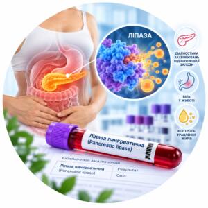 Аналіз панкреатичної ліпази (Pancreatic lipase) — Меді Лаб Плюс