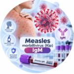 Визначення IgM до вірусу кору