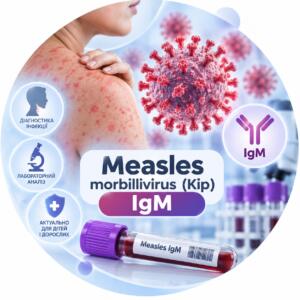 Визначення IgM до вірусу кору