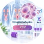 Mycoplasma hominis — qualitative PCR test