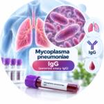 Mycoplasma pneumoniae — антитіла IgG