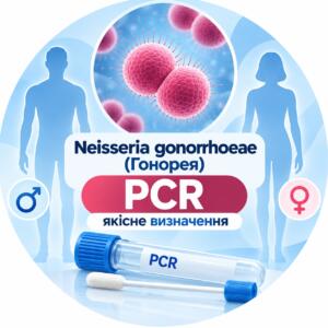 Neisseria gonorrhoeae — якісне PCR-визначення