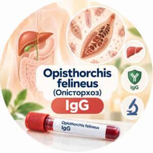 Opisthorchis felineus — антитіла IgG