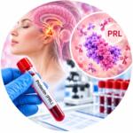 Prolactin (PRL) — a blood test to assess the level of a pituitary hormone
