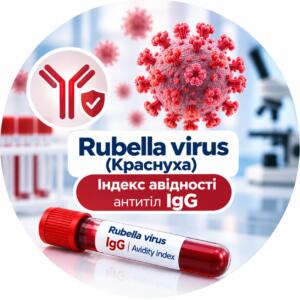 Rubella virus — індекс авідності антитіл IgG