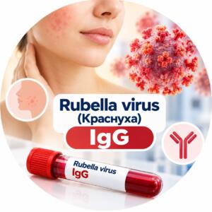 Rubella virus — антитіла IgG