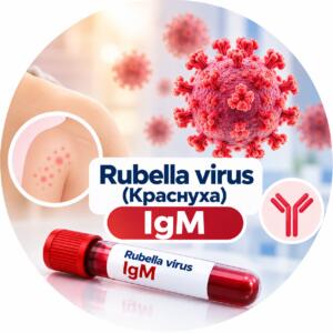 Rubella virus — антитіла IgM, висип на плечі
