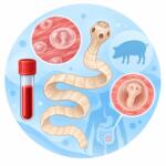 Taenia solium — IgG antibodies, cysticercosis
