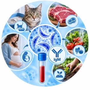Toxoplasmosis — main routes of infection and IgM antibodies